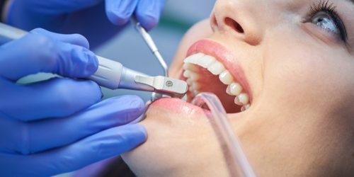 preventative dentist Dr. Brandon Dever DDS. North Auburn Dentistry. General, Cosmetic, Restorative, Preventative Family Dentistry Dentist dentist in Auburn CA 95603 preventative dentist Dr. Brandon Dever DDS. North Auburn Dentistry. General, Cosmetic, Restorative, Preventative Family Dentistry Dentist dentist in Auburn CA 95603