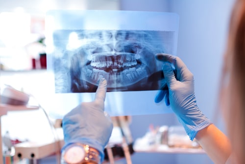 oral surgery auburn oral surgery auburn